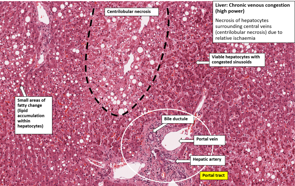 bad-side-effects-of-drinking-diet-coke-siowfa14-science-in-our-world